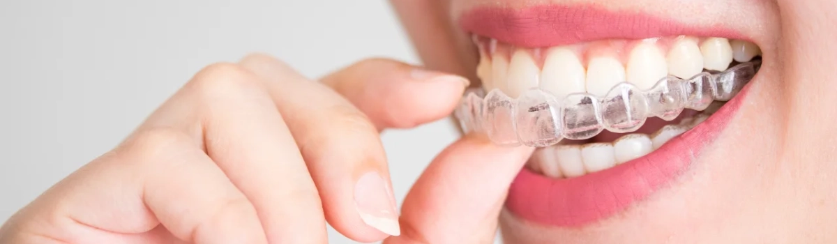 The Rising Trend of Cosmetic Surgery: Rhinoplasty and Orthodontics