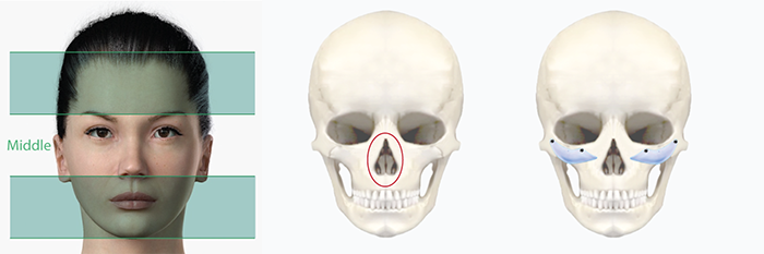 Middle_Facial_Surgery