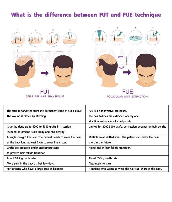 Strip_Fut_Hair_Transpalnt_(FUTX_and_Follicular_Unit_Extraction_(FUE)