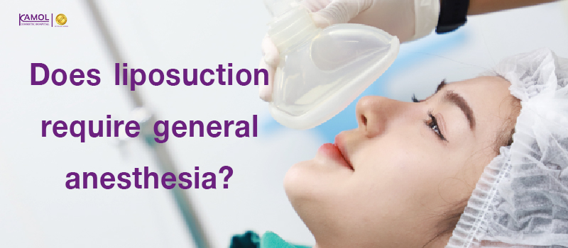 Does_liposuction_require_general_anesthesia?