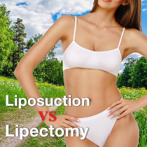 Liposuction of the Muffin Top Waistline Deformity - Explore Plastic Surgery