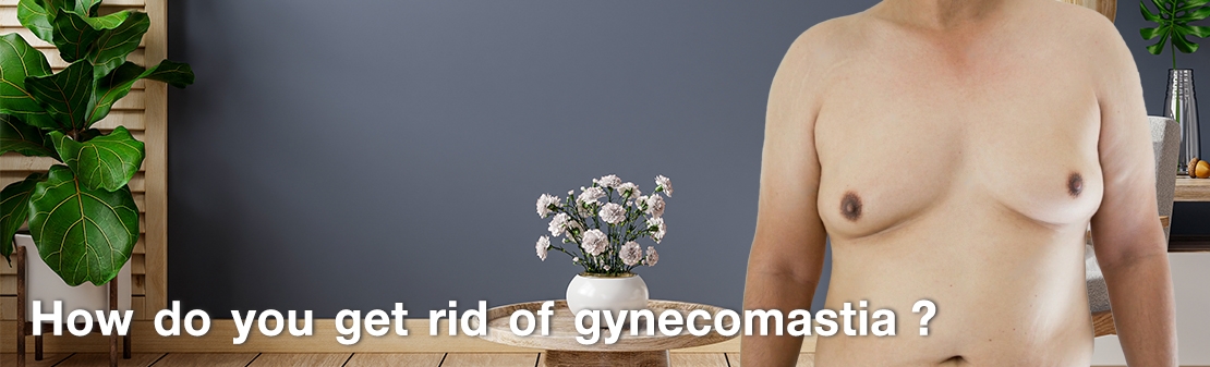 Comment se débarrasser de la gynécomastie ?