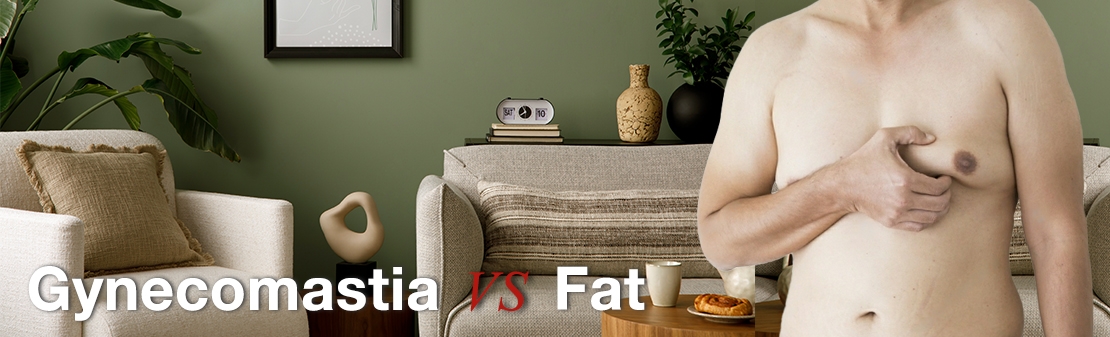 Comparing Gynecomastia and Excess Fat