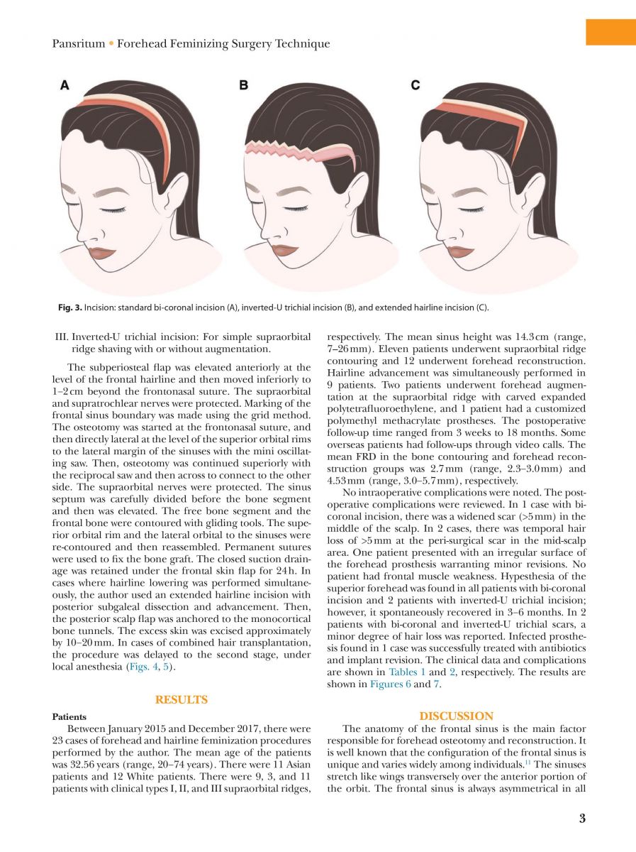 Pansritum,_Kamol_MD._(2021)._Forehead_and_Hairline_Surgery_for_Gender_Affirmation_Plastic_and_Reconstruction_Surgery_Journal