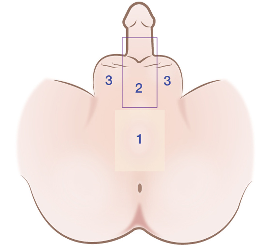 Area of the hair removal