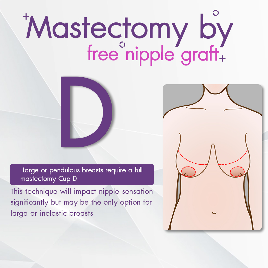 Free_nipple_graft_case_review