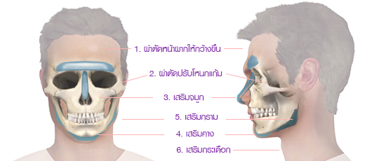  การผ่าตัดศัลยกรรมใบหน้า