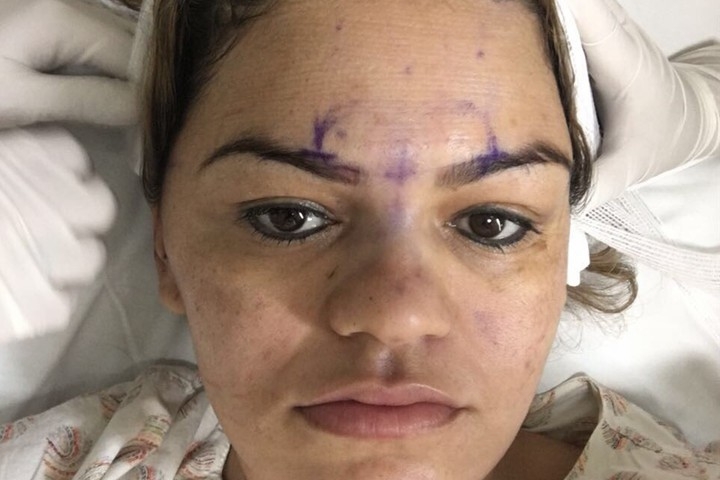Facial contouring