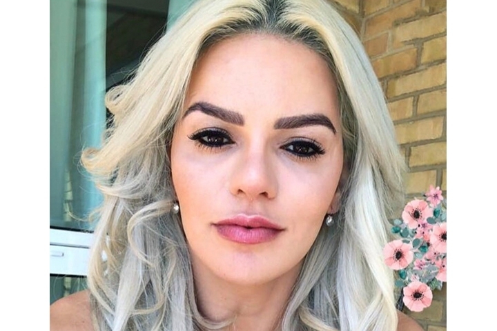 Facial contouring