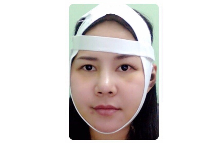 Reviews Jaw Reduction Surgery, Jaw shaving