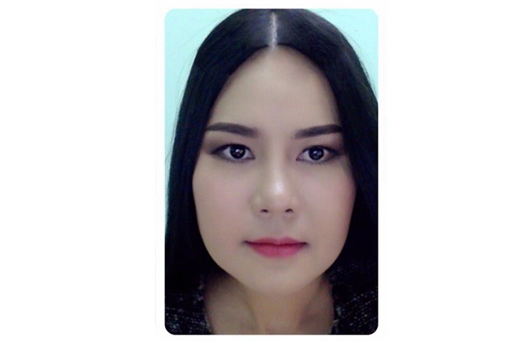 Reviews Jaw Reduction Surgery, Jaw shaving
