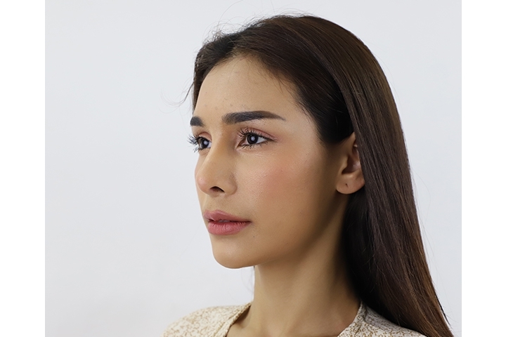 Reviews for Forehead Augmentation