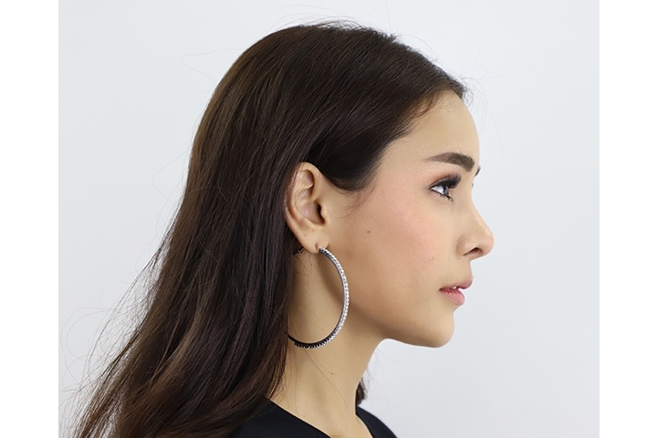 Reviews for Forehead Augmentation