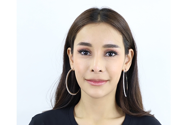 Reviews for Forehead Augmentation