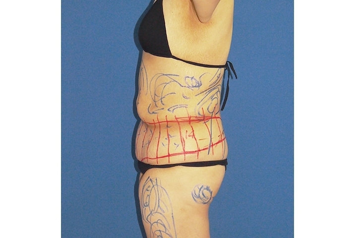 Contouring