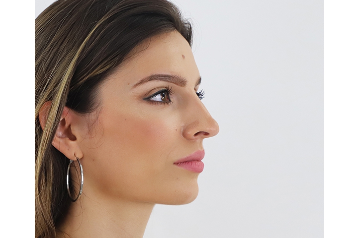 Amazing Nose Reshaping shared by Ainara