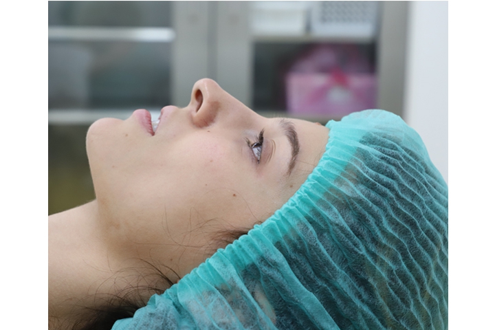 Revision Rhinoplasty