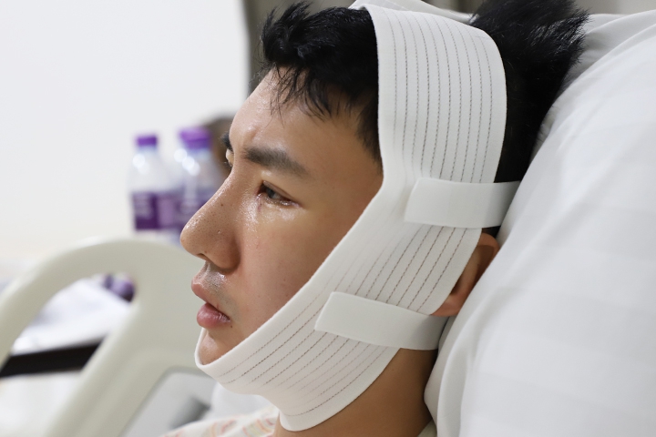 Jaw Augmentation