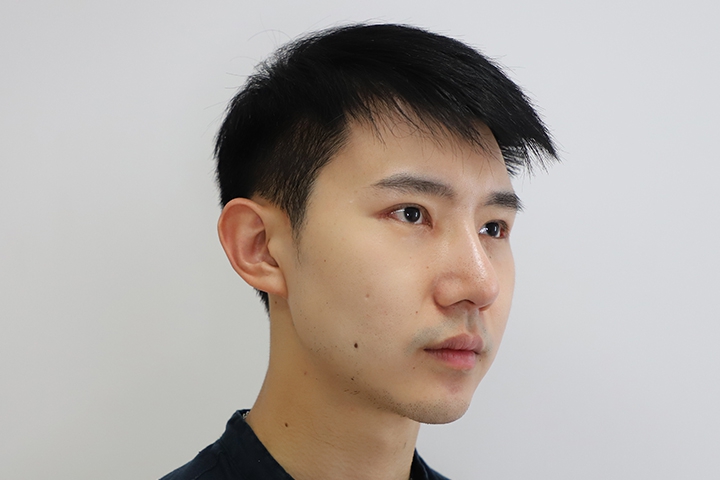 Jaw Augmentation