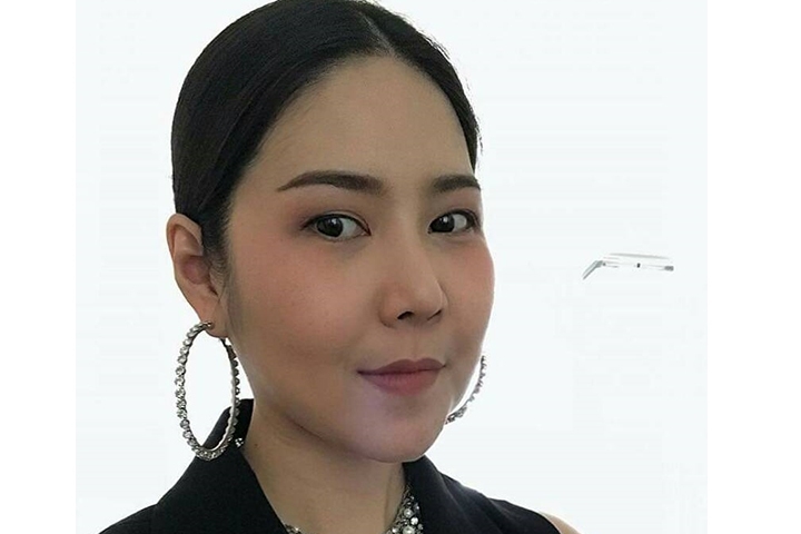 Cheekbone Reduction, Zygoma Reduction