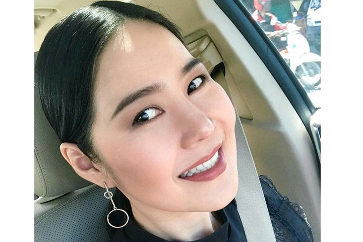Cheekbone Reduction, Zygoma Reduction