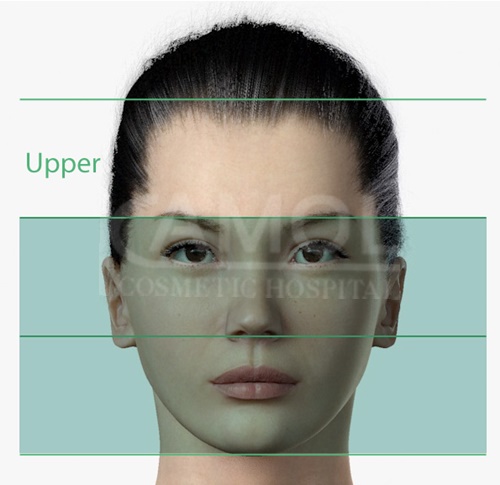 The_Upper_Part_of_Facial_Surgery