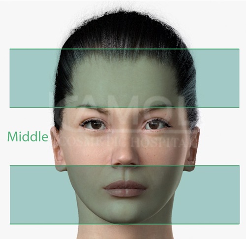 The_Middle_Part_of_Facial_Surgery
