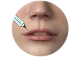 Lips_Enhancement_by_filler_injection