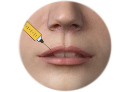 Lips_Enhancement_by_Fat_Graft