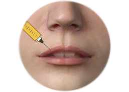 ภาพแสดงการผ่าตัดเสริมริมฝีปากโดยฉีดไขมันตัวเอง