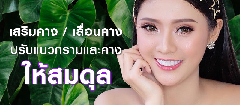 เสริมคาง/เลื่อนคาง