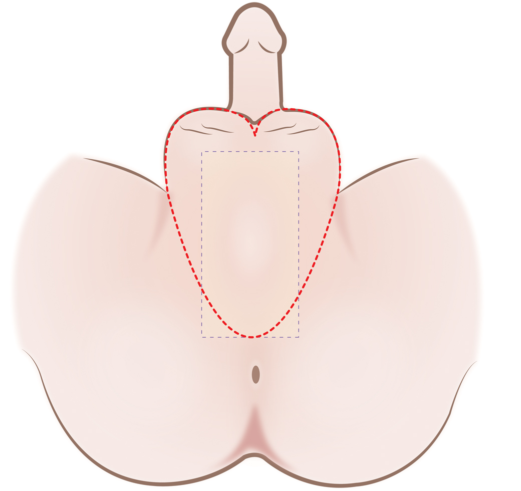 Area of the hair removal
