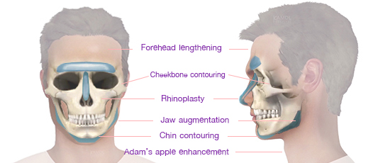 Shows masculine procedures.