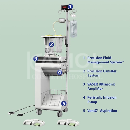 shows the VASER ® Liposuction System 
