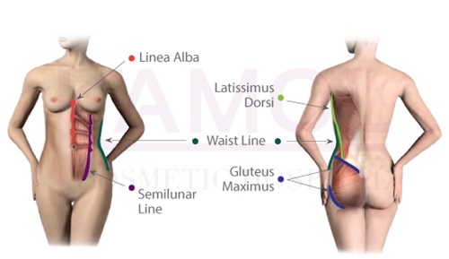 Six Pack Surgery - Apex Clinic