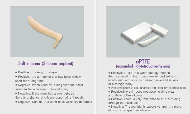 Advantage_of_silicone_nose_implant_campare_with_ePTFE_nose_implant